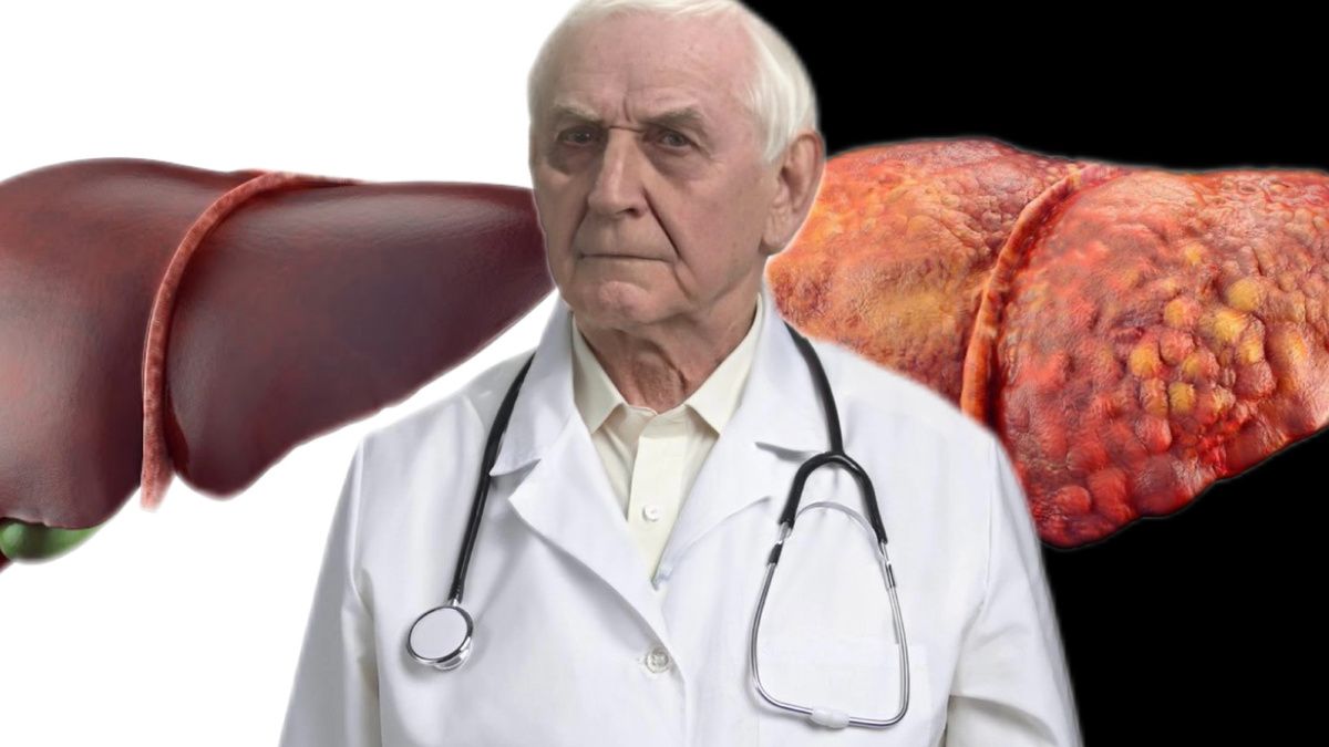 ������� ���������: ��� ������� ���������� ������ ������